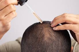 Kirkland Minoxidil & Derma Roller